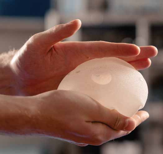 Canfem breast prosthesis