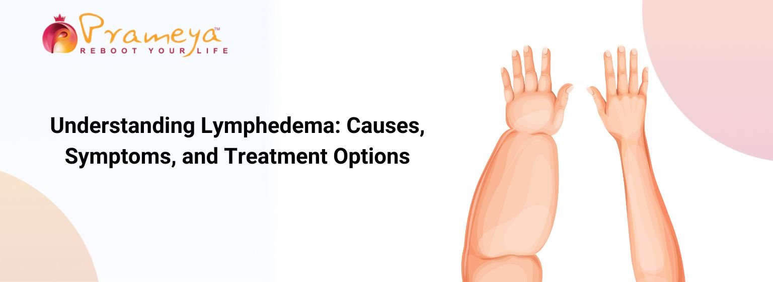 Lymphedema