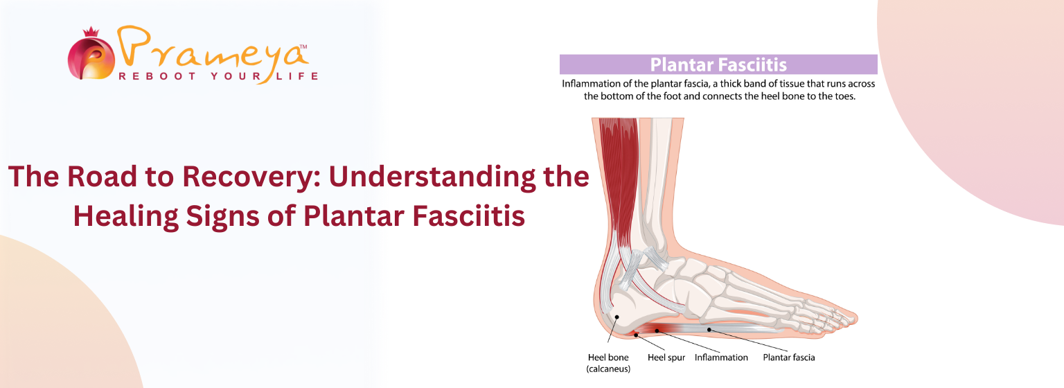Plantar Fasciitis